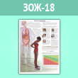 Плакат «Риски ожирения» (ЗОЖ-18, ламинированная бумага, A2, 1 лист)